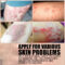 15g Natural Psoriasis Ointment Eczematoid Skin Pruritus Care Dressing Effective Treatment Dermatitis Eczema Antibacterial Cream
