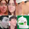 Acne cream herbal essence anti-inflammatory, anti-acne, anti-acne, anti-acne, oil control, suitable for all kinds of acne