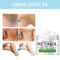 Retinol Cream Underarm Knee Buttocks Private Bleach Remove Melanin Pigmentation Improve Dull Brighten Whitening Skin Care